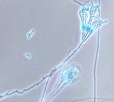 Filamentous fungi (Mould=Mold): (Morphology) Aspergillus is #2 pathogen Fungi.