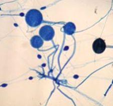A hypha (plural hyphae): is a long, branching filamentous cell.