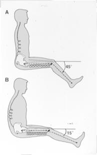 Back Pain 1 month later Nordin & Frankel 1989 Lumbar Extension Syndrome
