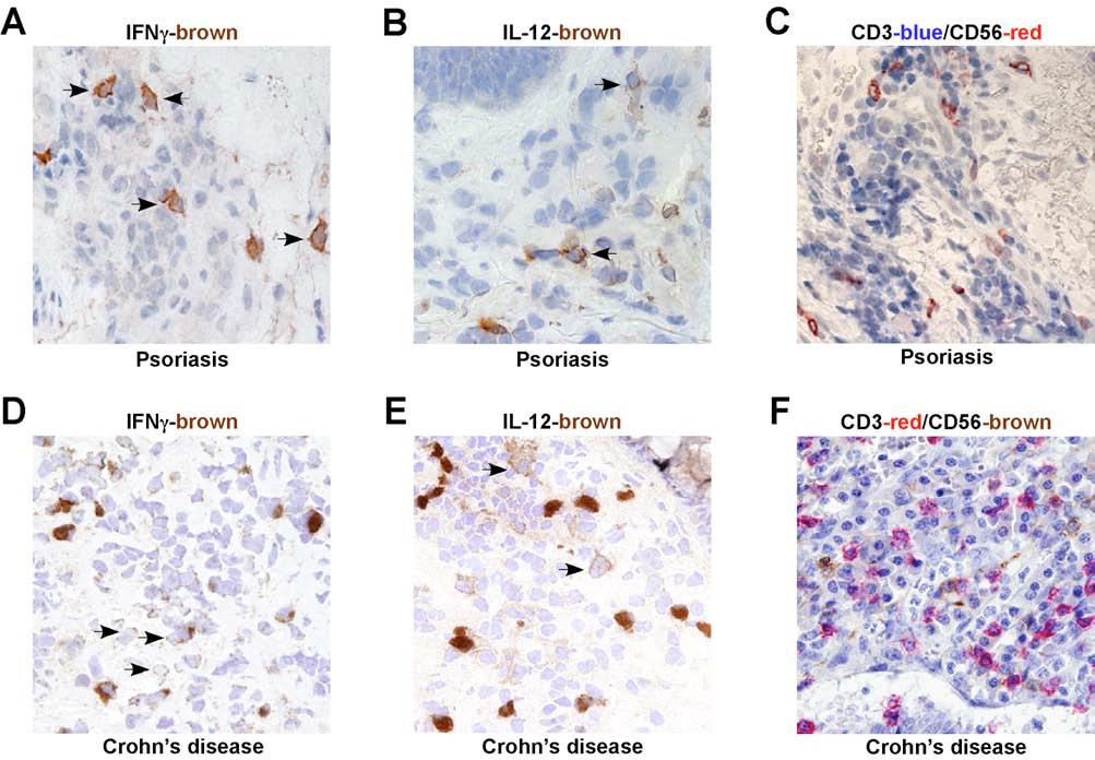 Figure S6. Identification of NK cells and staining of IL-12 and IFNγ by immunohistochemistry.