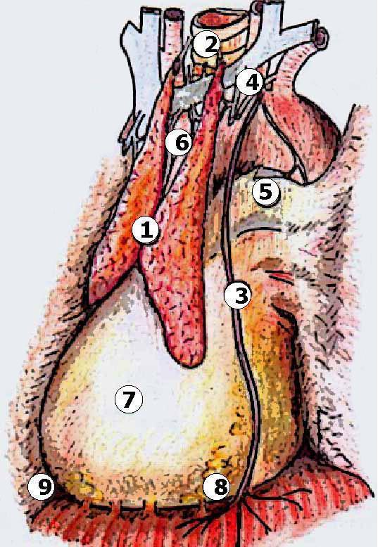 The thymus gland Anterior mediastinum Prominent in