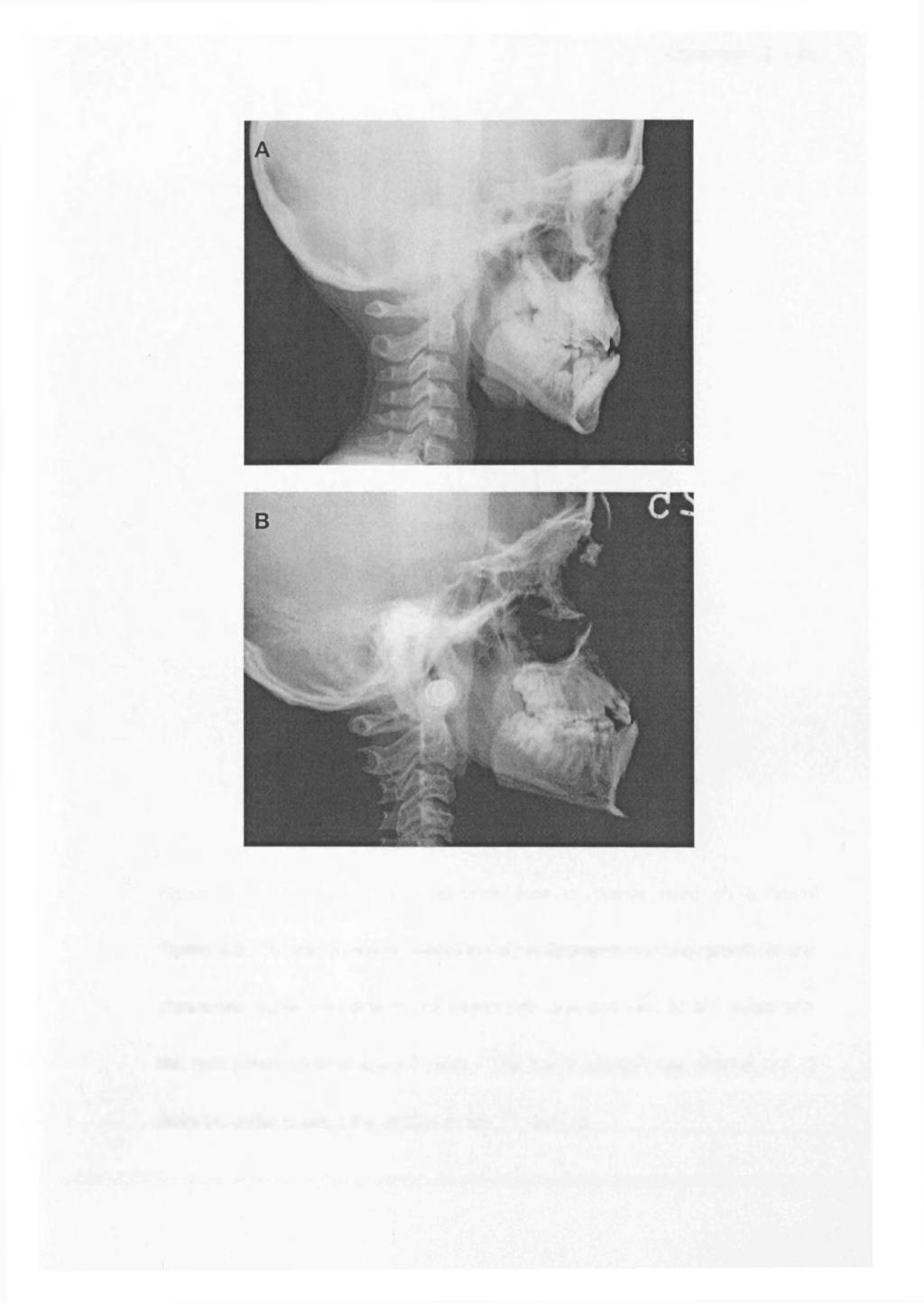 Appendix B 138 Figure 4.2.