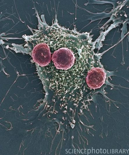 Types of White Blood Cells Lymphocytes B cells - make antibodies that destroy antigens(germs) T