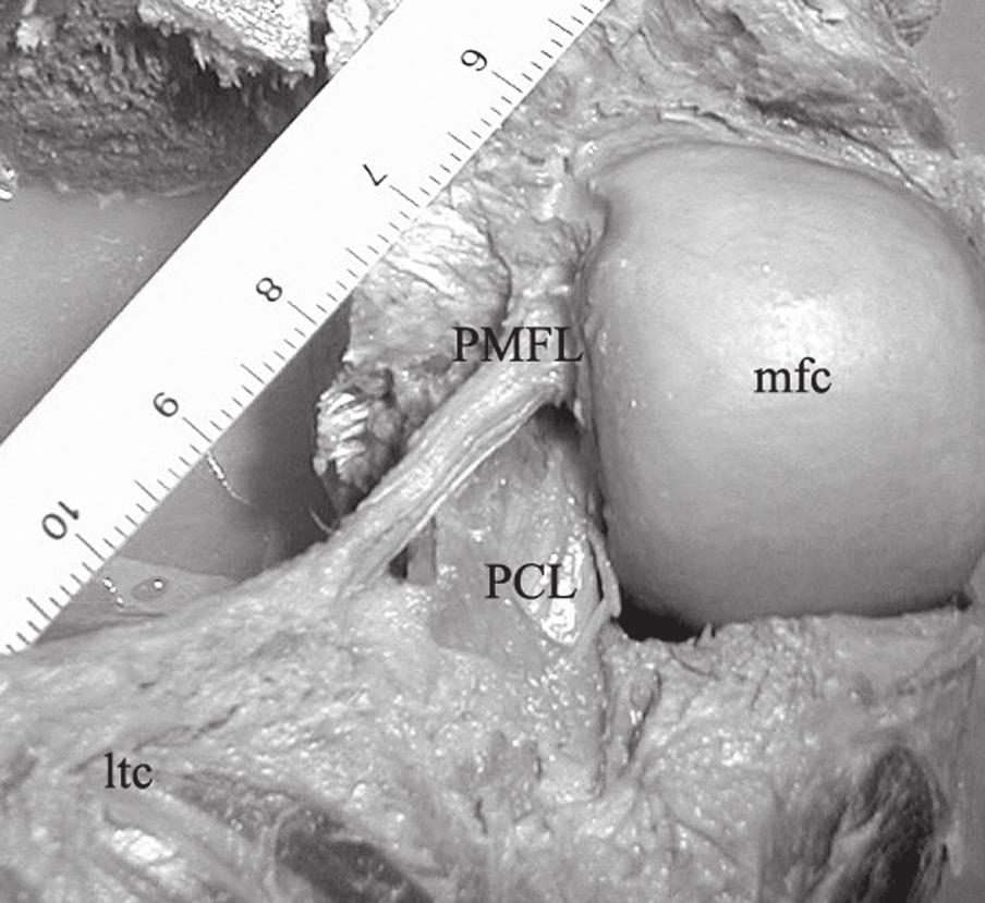 Some investigators claim that the PCL has a monofascicular structure [5, 7, 8]. A similar view was presented by Satku et al.