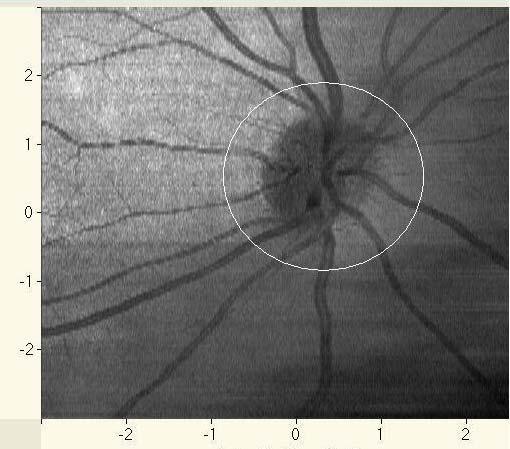Retinal perfusion is integrated over 2 seconds speed (m m /s) 7 6 5 4 3 2 No.2 No. 1 16 17 1 2 3 4 5 6 7 8 9 1 15 10 0 0 0.5 1 1.