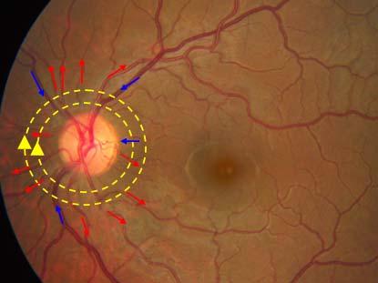 The dual circular scan OCT Doppler retinal blood flow measurement technology has been