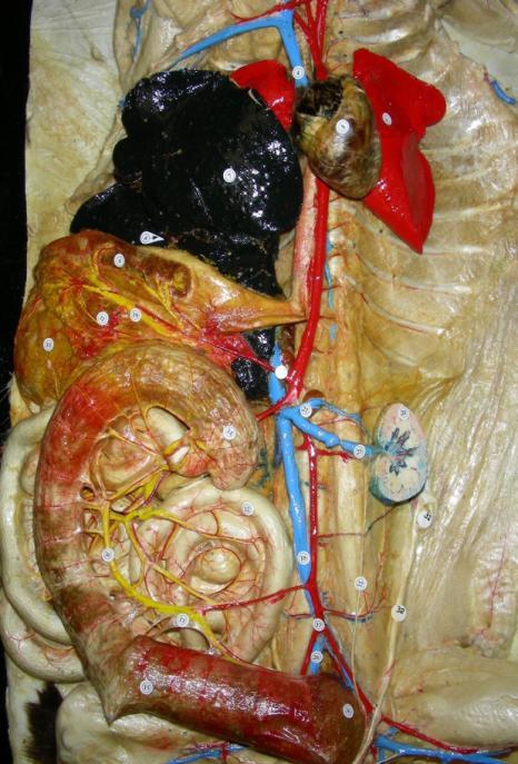Right Subclavian 9. Posterior Intercostals 9 Arteries:.