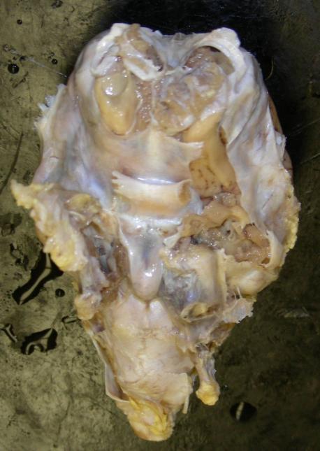 . Olfactory bulb (CN I). Optic chiasma (CN II). Pituitary gland. Trigeminal nerve (CN V). Pons. Medulla oblongata 8.