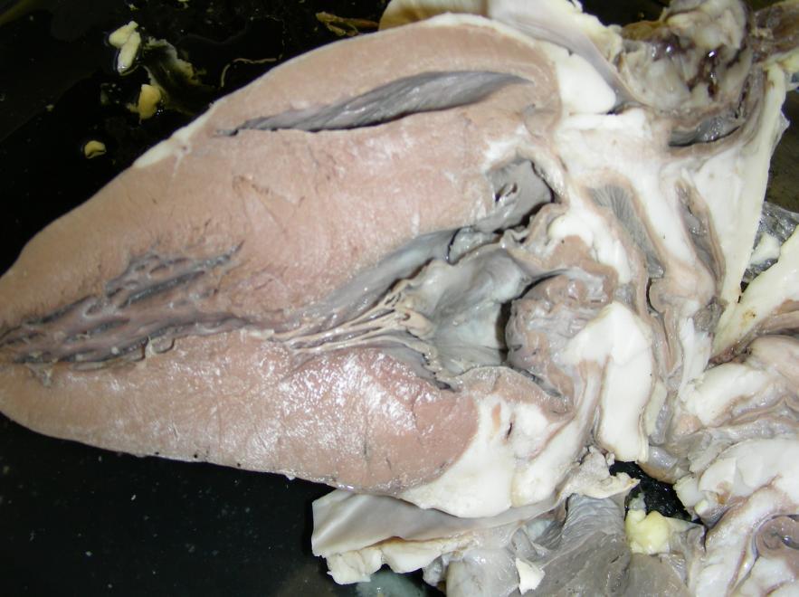 . Aorta. Superior vena cava. Pulmonary artery. Aortic semilunar valve.