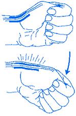 radial styloid, swelling, thickening DeQuervain s Tenosynovitis Finkelstein s Test Flex the thumb into the palm and close the