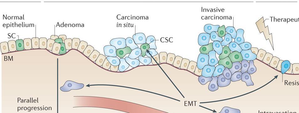 Multi-step cancer progression Colon cancer Normal epithelium APC