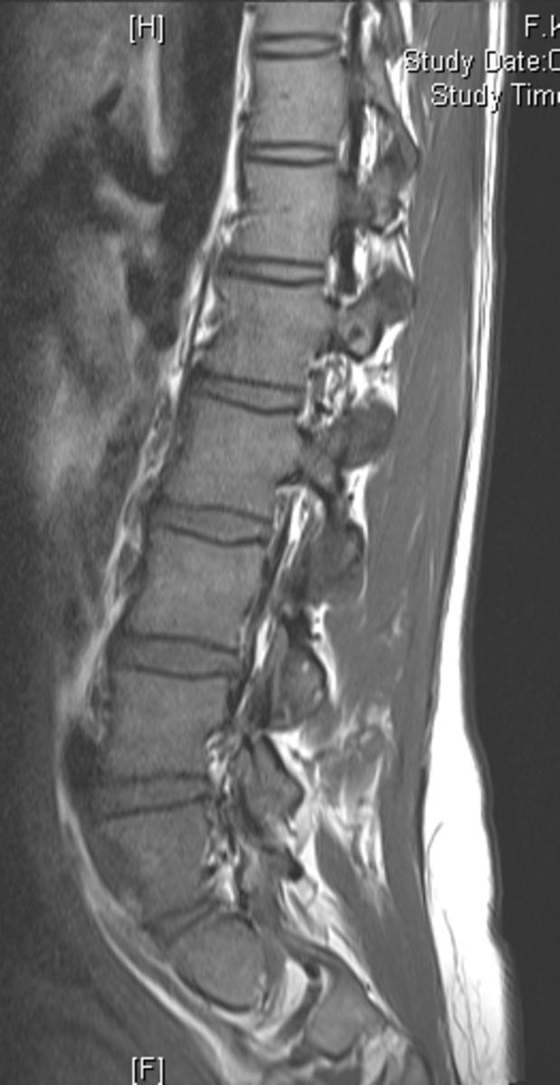 Fig. 0: Figure 11c: Abnormally prominent venous plexus in a pregnant female.