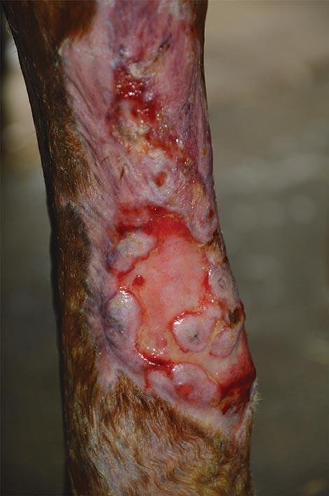 Epithelialisation is evident from both the grafts, as well as from the wound edge, 137 days following the original injury and 90 days following the implantation of pinch grafts.