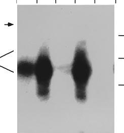 HeL cell nucler extrct ws sujected to immunoprecipittion with either rit nti mouse (rm, lnes 2 nd 5), preimmune (PI, lnes 3 nd 6) or nti-al polyclonl 543 ntiodies (lnes 4 nd 7).