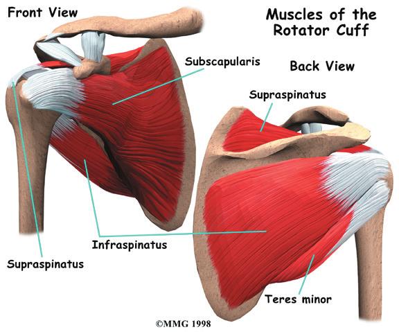 This guide will help you understand what happens in the shoulder with calcific tendonitis what tests your doctor will run to diagnose this condition what you can do to help relieve the pain Calcific