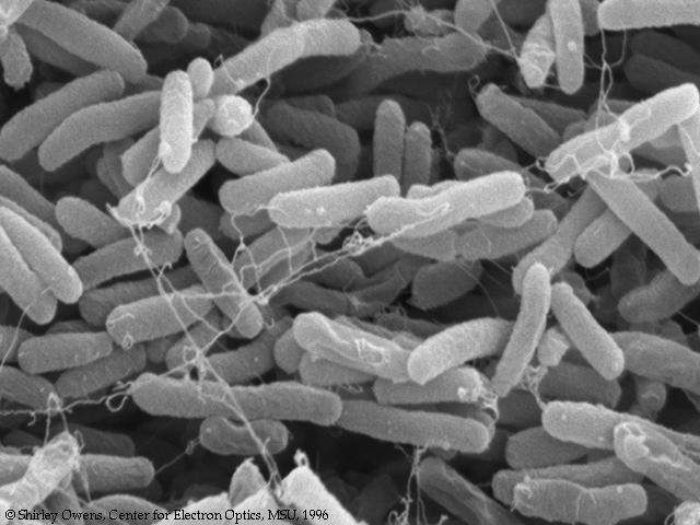 You ve got company! PEE-YOO! Living in the large intestine is a community of helpful bacteria u Escherichia coli: E.