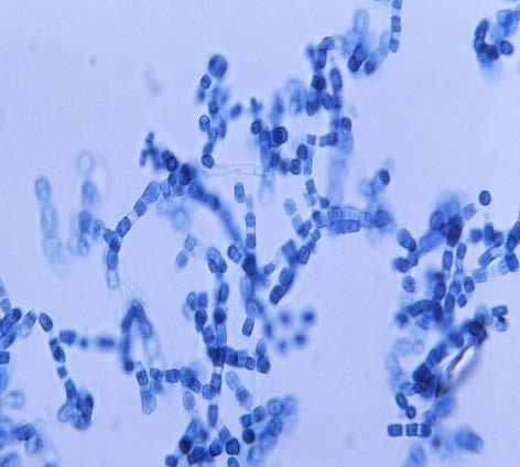 Background on Coccidioidomycosis Also called Valley Fever or cocci Caused by Coccidioides spp.