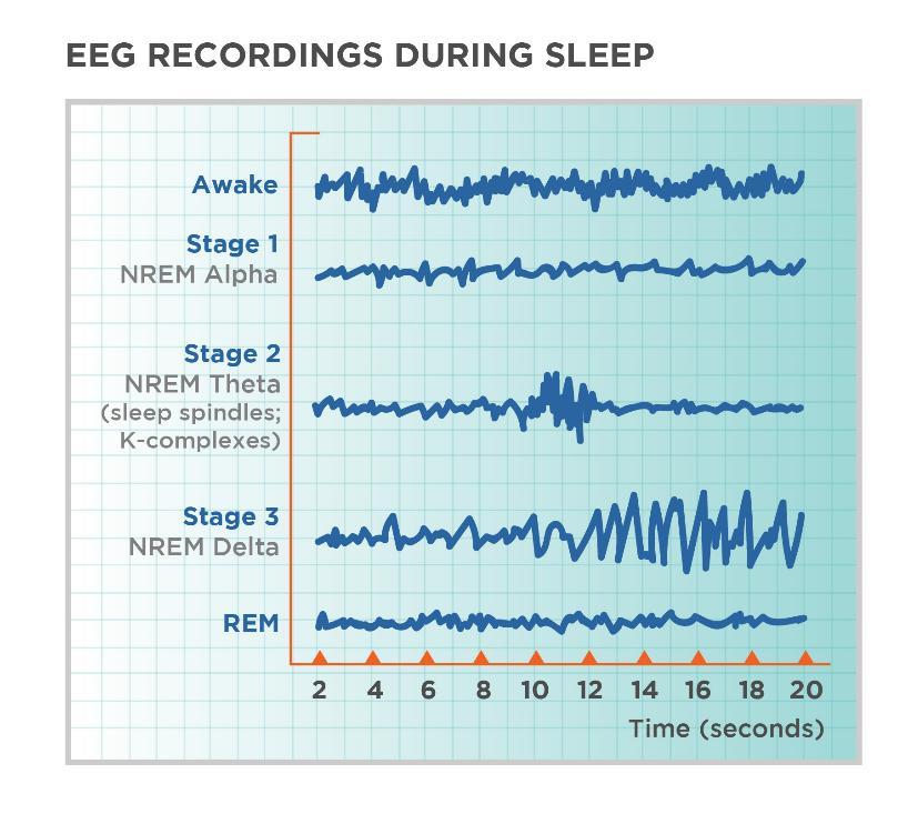 SLEEP STATES: REM & NON-REM SLEEP Each is regulated by a different part of the brain Difference between those states is as profound as the difference between sleep and wakefulness.