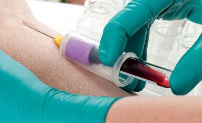 screening: OraQuick HCV Rapid Antibody test in fingerpick blood Referral of positives for