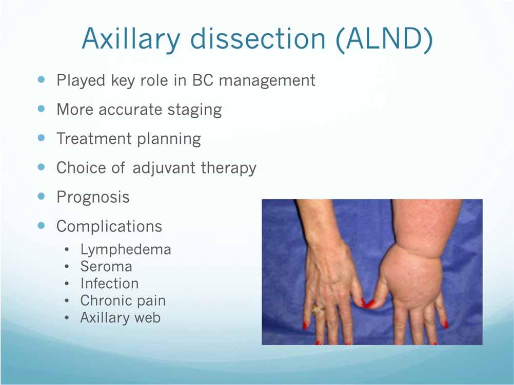 Axillary dissection (ALND) Played key role in BC management More accurate staging Treatment planning