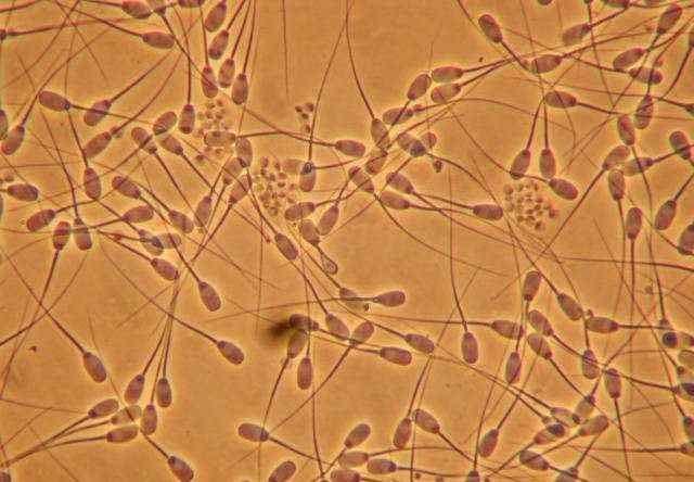 Challenges: Cell Morphology Spermatozoa Non-spherical cell type