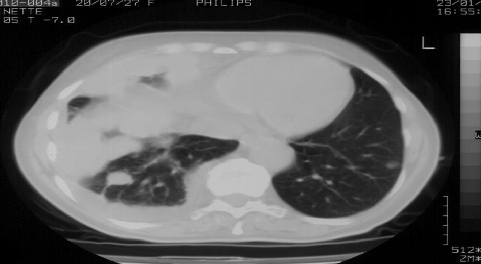 Lessons from clinical case 73 year old lady