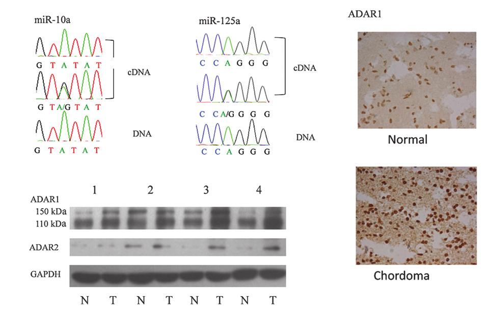 MOLECULAR MEDICINE REPORTS 12: 93-98, 2015 97 A C B Figure 3. RNA editing caused by overexpression of ADAR1 and ADAR2.