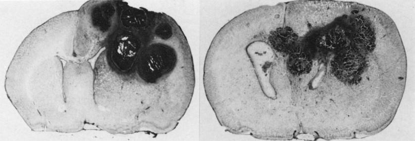 Methylprednisolone and peritumoral brain edema FIG. 2. Macroscopic appearance of the untreated (left) and methylprednisolone-treated (right) animals.