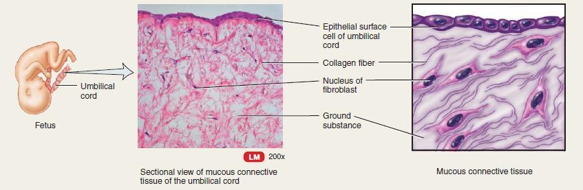 Mucous connective tissue Description: widely scattered fibroblasts and collagen