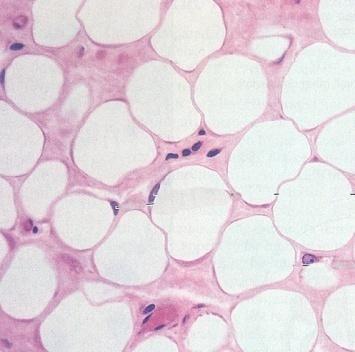 Adipose Tissue Description Closely packed adipocytes Have nucleus pushed to one side by fat droplet.