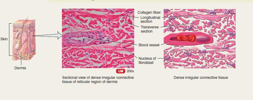 Dense irregular connective tissue Description: randomly arranged collagen fibers and few fibroblasts