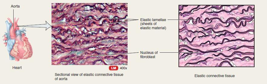 Elastic connective tissue Description: Consists predominantly of elastic fibers and fibroblasts Location: lung, wall