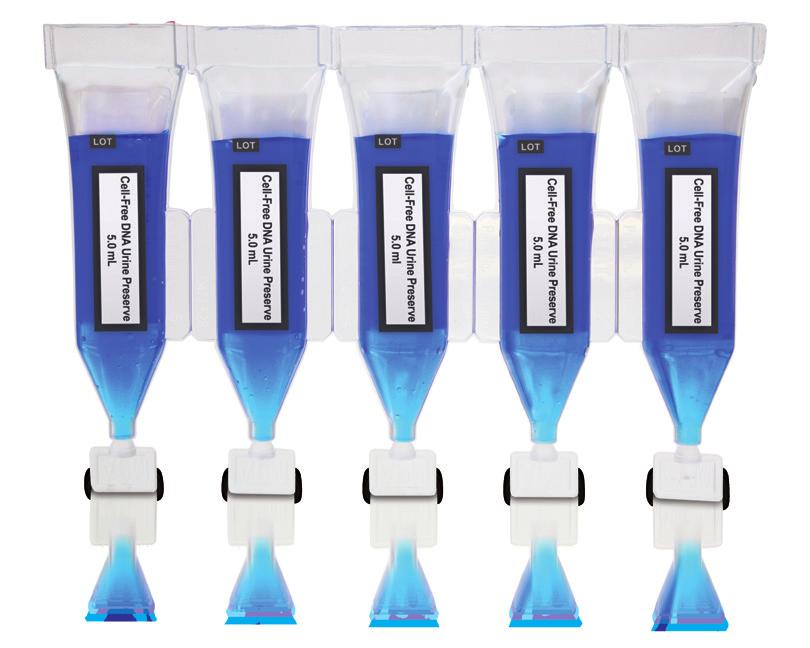 Cell-Free DNA Urine Preserve Urine Preservative Streck Cell-Free DNA Urine Preserve is an innovative, easy-to-use liquid preservative that stabilizes cfdna in urine samples.