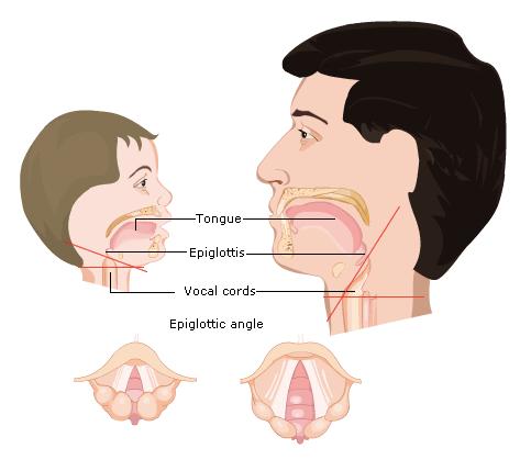 than in the adult and the epiglottis is longer and less flexible.