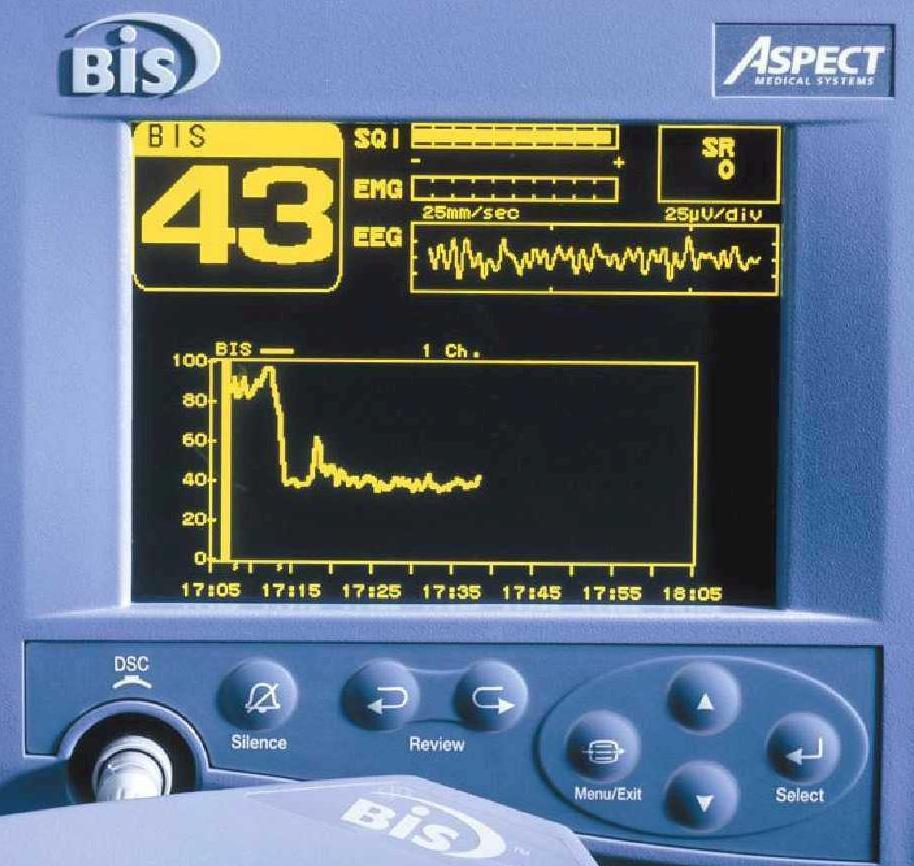 Use of BIS Monitoring TH Adequate sedation during NMBA Recognition of awake