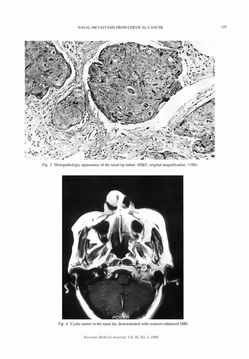 NASAL Fig. 3. Histopthologic Fig. 4.