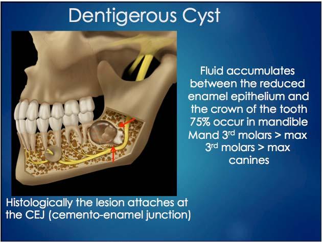 junction) Significant tooth displacement Even in this