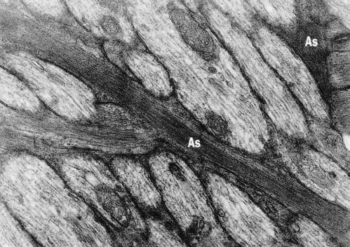 B, Transmission electron micrograph of optic nerve axons (lighter cells) of lamina choroidalis.