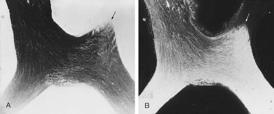 Light-field (A) and dark-field (B) autoradiographs of a horizontal section through the optic chiasm of a macaque monkey.