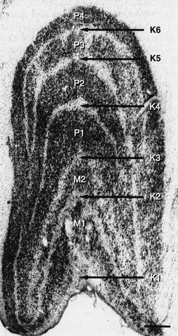 Axial section of brain demonstrating lateral geniculate body and surrounding structures. (From Lindenberg R, Walsh FB, Sacks JG. Neuropathology of Vision: An Atlas. Philadelphia, Lea & Febiger, 1973.