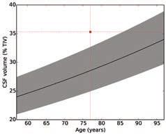 age and sex using a log-linear model [9].