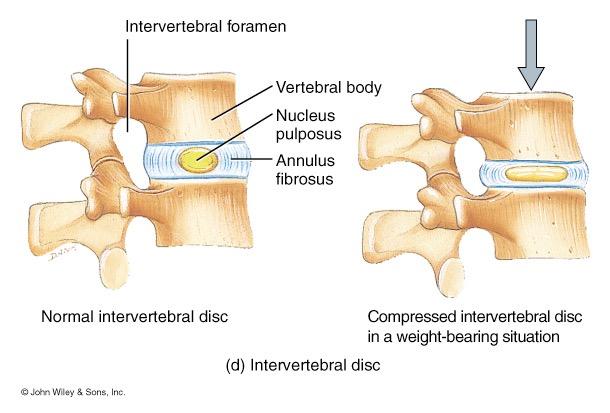 fused) coccyx (4, fused) Intervertebral Discs Normal Curves of the Vertebral Column Between adjacent