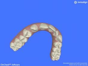 Dentistry Using Orthodontics CC1 Start CC2 End CC2 Tracking at End of