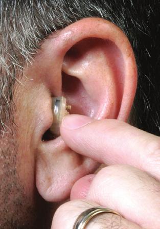 For easier insertion, use your other hand to slightly pull-up on the top of the ear. Using your forefinger, gently push in the device (Fig. 2).
