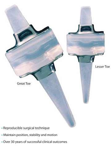 Total Implants Hinged silastic Maintains position, stability and motion >30 years of