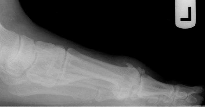 Radiographic findings