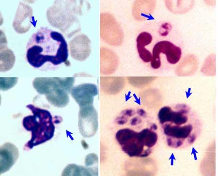 WBCs Toxoplasma gondii