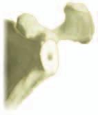 It is seated on the scapula pillar for the supero-lateral approach or at the posterior part of the glenoid on the deltopectoral approach.