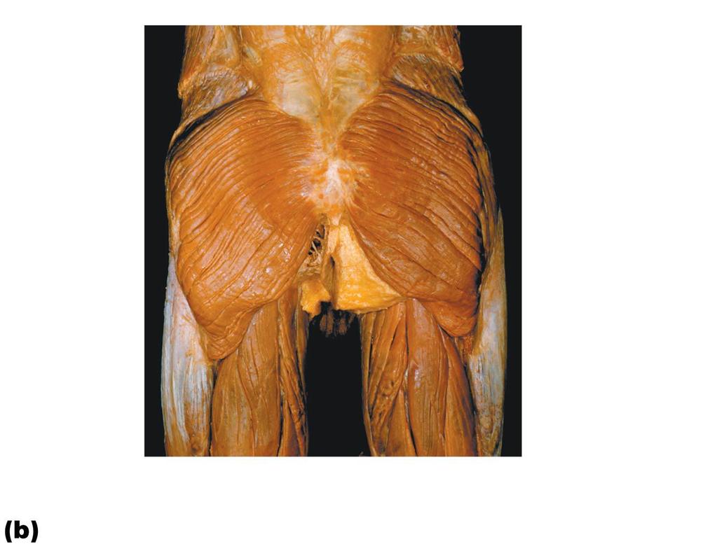 Figure 10.21b Posterior muscles of the right hip and thigh.