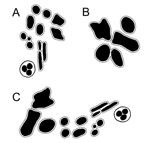 Figure 2. Architectural patterns of melanocytic nevi. A, Epidermal: Prominent epidermal rete and infundibula. B, Keratotic: Prominent surface and infundibular hyperkeratosis.
